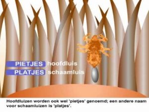 schaamluis