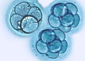embryopolitiek